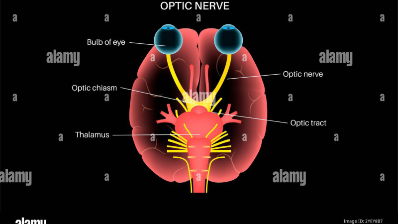 retinal ganglion cell apoptosis oxidative stress pathway diagram