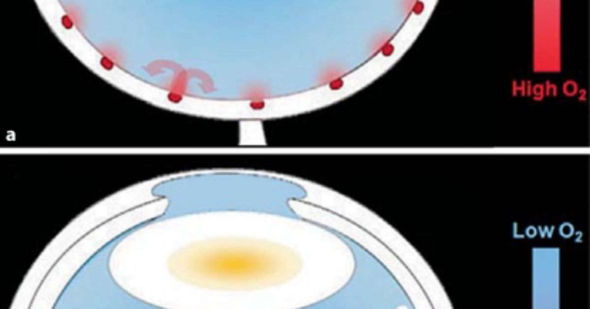 Visivra : Comment les antioxydants combattent l'opacification du cristallin liée à l’âge