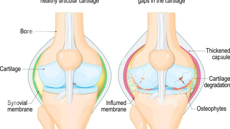 synovial fluid anatomy diagram