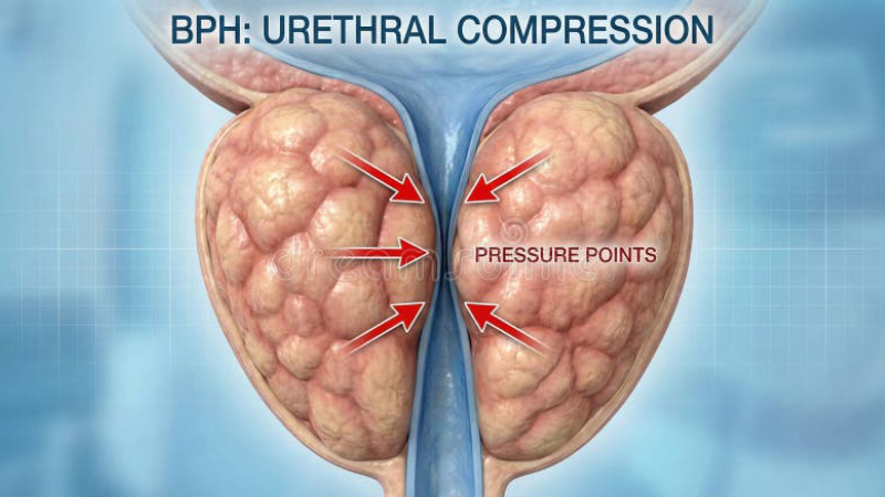 prostate anatomy illustration