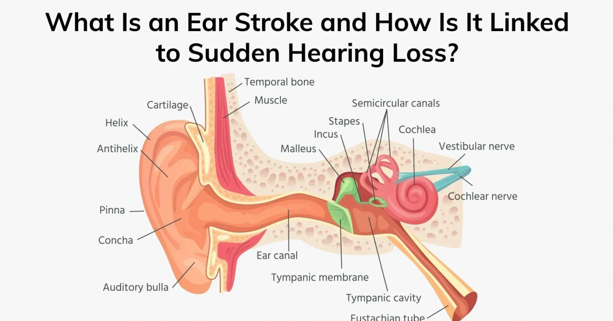 AquaPeace: Sudden Hearing Loss – The ‘Ear Stroke’ Phenomenon Explained
