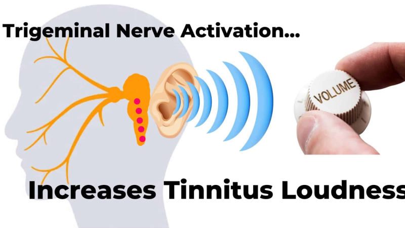 illustration of trigeminal nerve pathways to dorsal cochlear nucleus