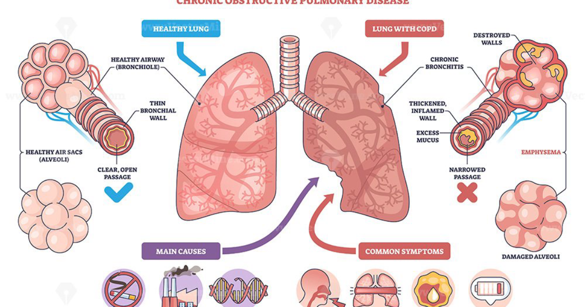 Breathe: The Physiological Mechanisms Behind Respiratory Support and Lung Health
