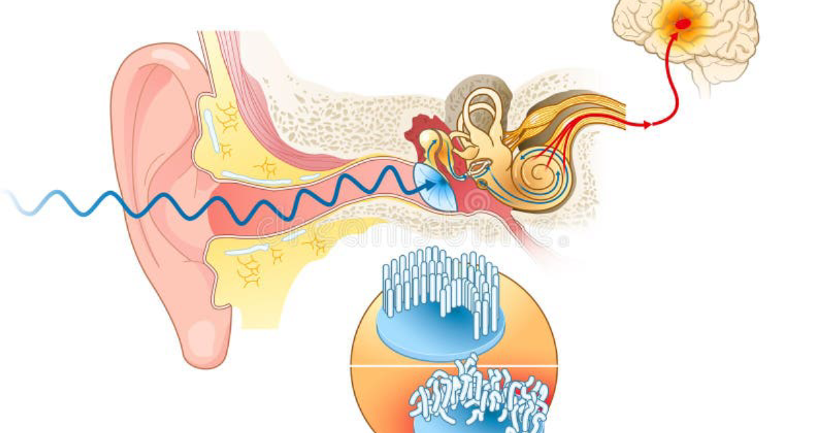 EchoXen: What Is an Ear Stroke? The Surprising Link Between Sudden Hearing Loss and Your Brain