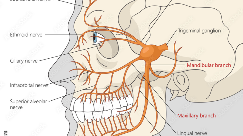 anatomy of trigeminal nerve showing branches to jaw, face, and connection to cochlear nucleus