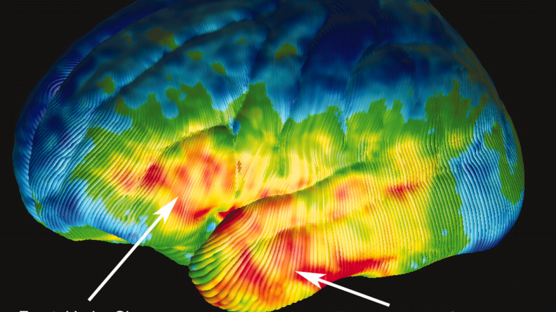 cochlea inner ear hair cells microscope