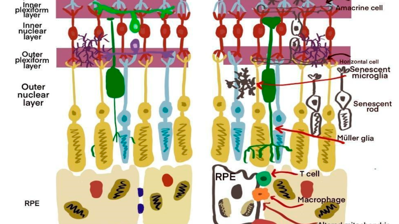 microscopic view of retinal pigment epithelium cells with oxidative stress damage