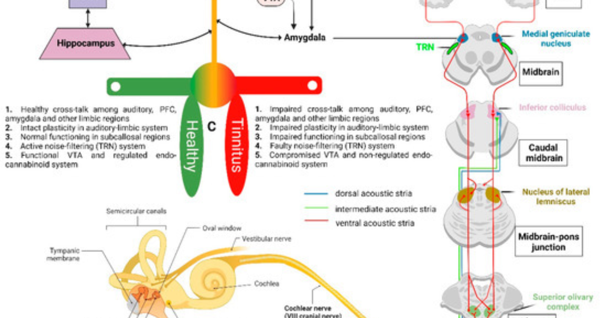 Quietum Plus: Can Diet Tame Tinnitus? Exploring Glutamate-Rich Foods and Auditory Nerve Excitability