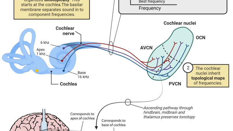 auditory cortex hyperactivity neural firing illustration