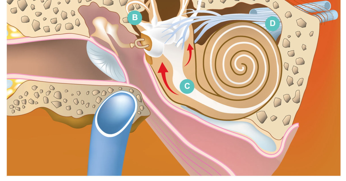 Quietum Plus: How High-Sodium Foods Worsen Cochlear Fluid Imbalance and Tinnitus