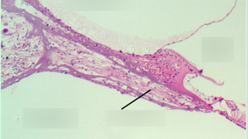 microscopic view of cochlear blood vessels
