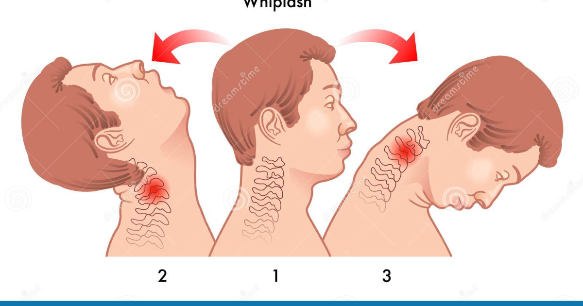 Quietum Plus: The Science Behind Whiplash and TMJ-Induced Tinnitus