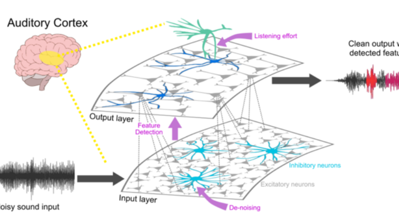 brain neural network auditory cortex hyperactivity illustration
