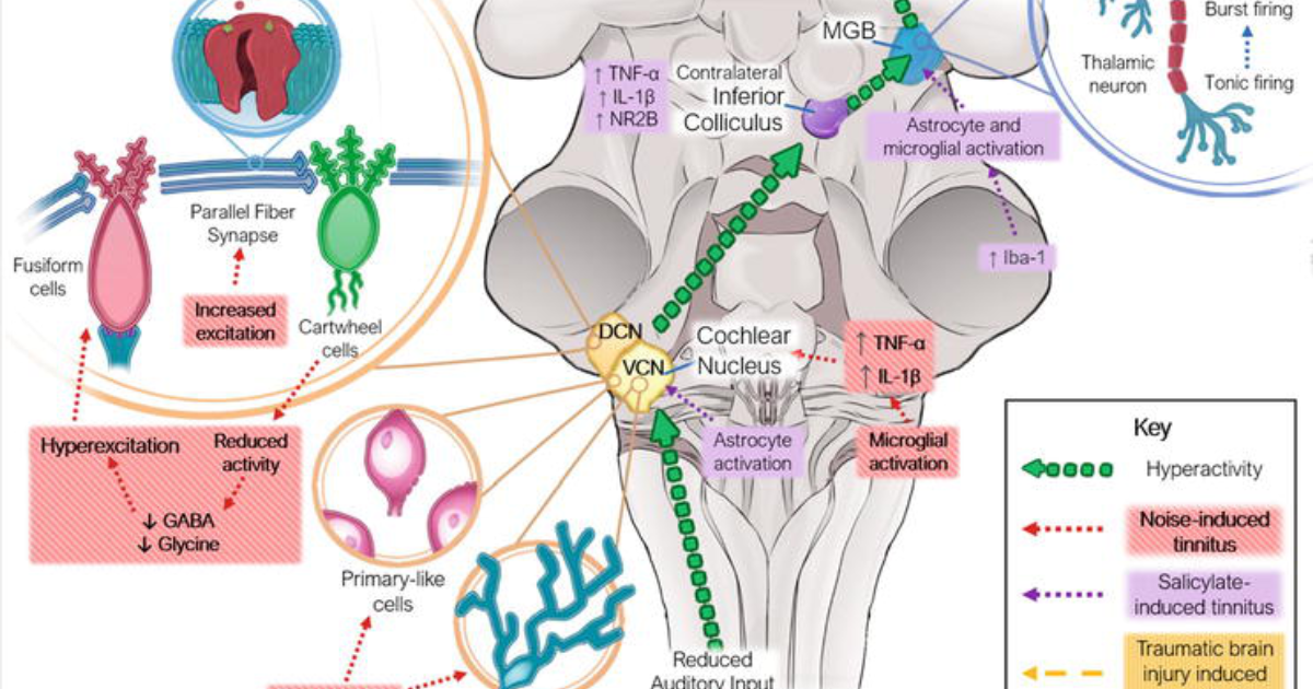Ringzen 6: Can Glutamate Regulation Silence Tinnitus?