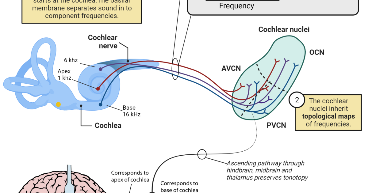 Ringzen 6: Can You Train Your Brain to Stop the Ringing? Auditory Cortex Plasticity and the Science of Tinnitus Relief