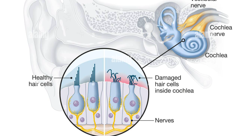 damaged cochlear hair cells microscope close up