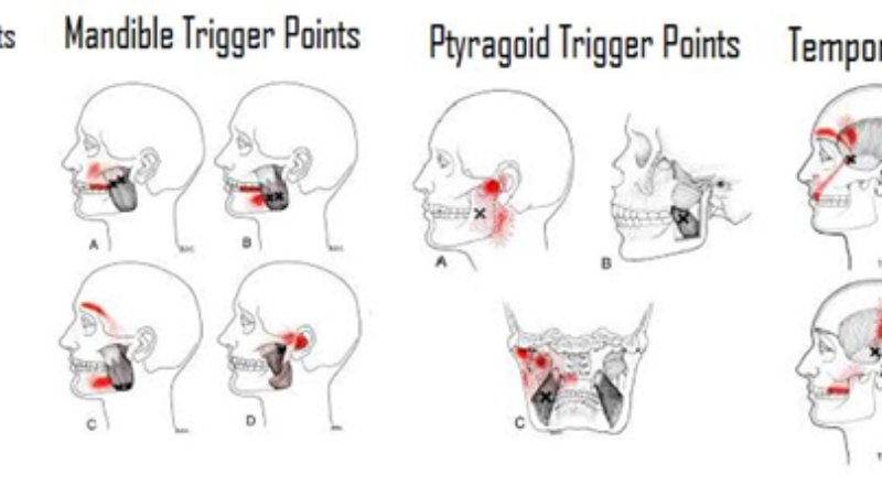 human neck and jaw anatomy highlighting trigeminal nerve and upper cervical spine