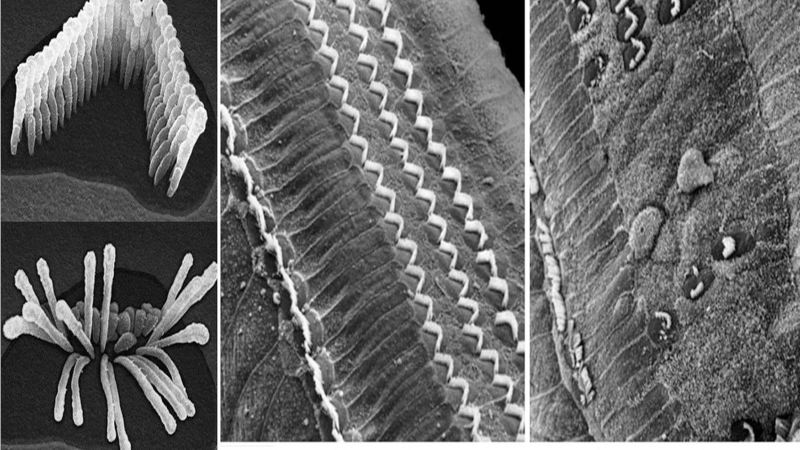 cochlea outer hair cells and salicylate damage mechanism illustration