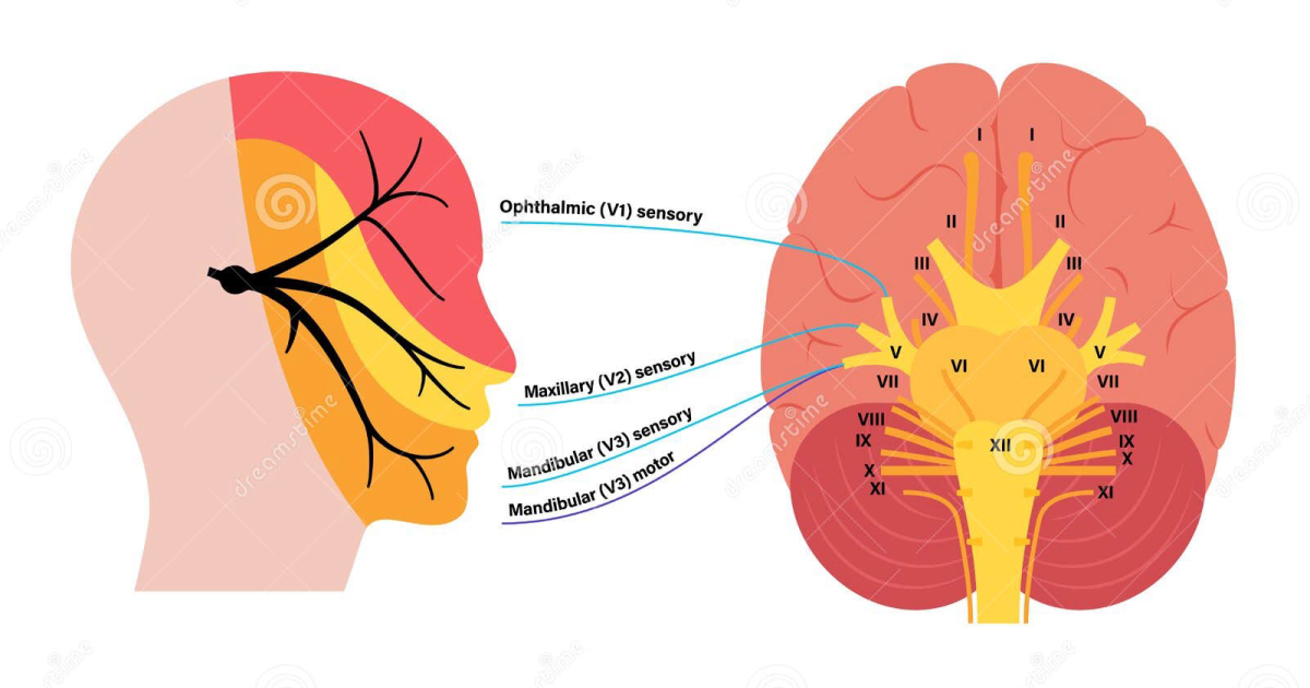 Sonus Complete: The Trigeminal Connection — Why Jaw Clenching and Neck Tension Can Trigger Tinnitus