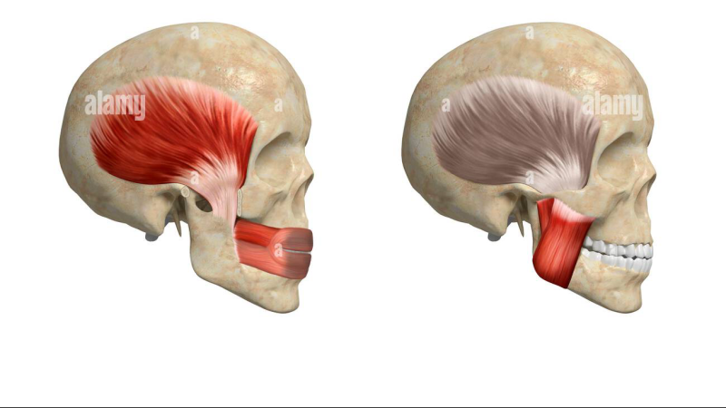 illustration of trigeminal nerve connections to cochlear nucleus
