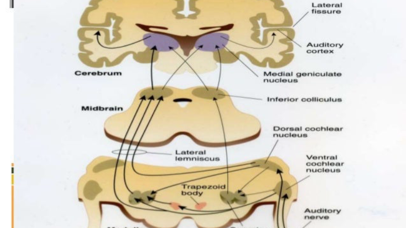 auditory cortex amygdala pathway illustration