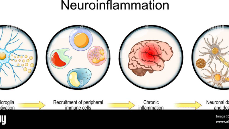cerebral microglial activation neuroinflammation