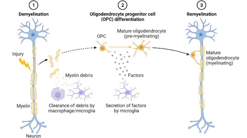 oligodendrocyte precursor cells differentiating into myelinating oligodendrocytes