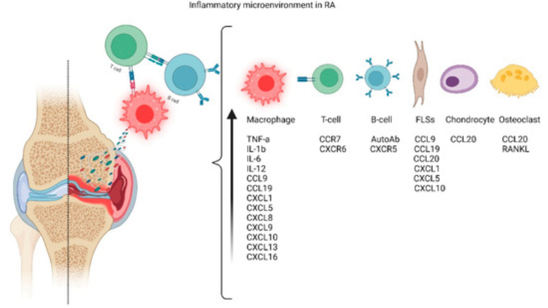 joint synovial fluid inflammation illustration
