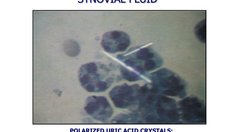 microscopic view of synovial fluid between cartilage surfaces
