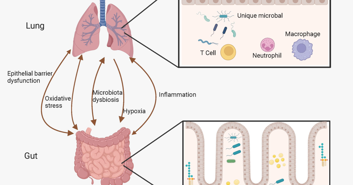 Pulmo Balance: Il Legame tra Disbiosi Intestinale e Gravità dell'Asma – Una Prospettiva Molecolare
