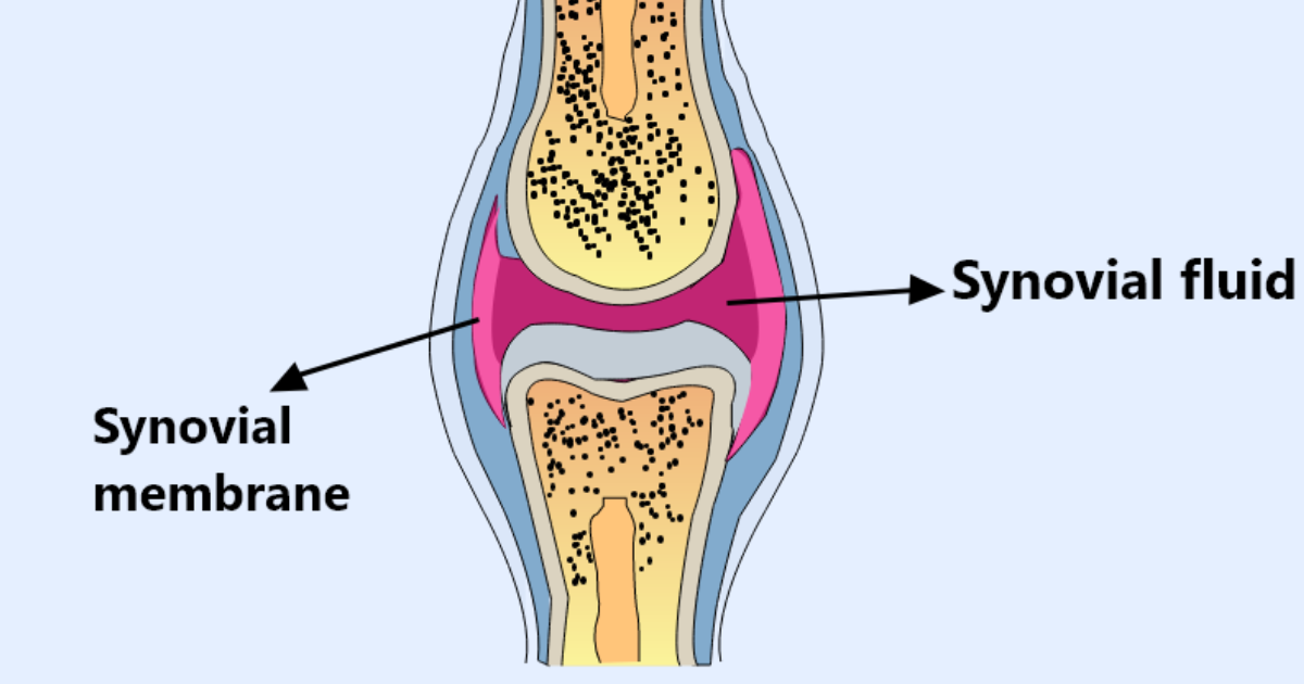 Arthro MD+: 3 Common Foods That Sabotage Synovial Fluid Viscosity and Joint Mobility