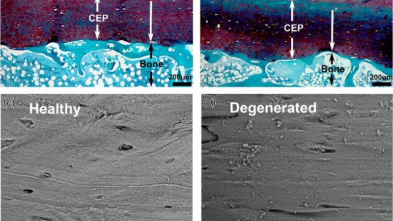 healthy vs degenerated articular cartilage microscope comparison