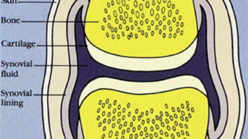 knee joint anatomy inflammation illustration