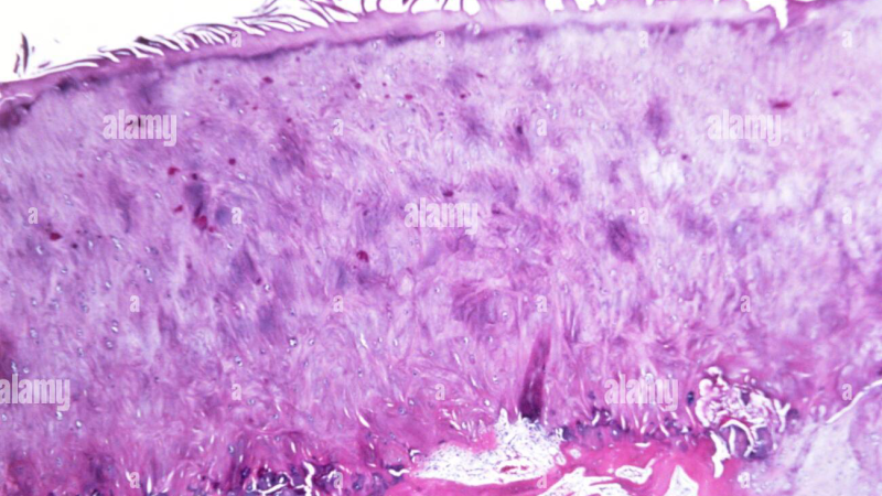 collagen fibril joint cartilage damaged vs healthy illustration