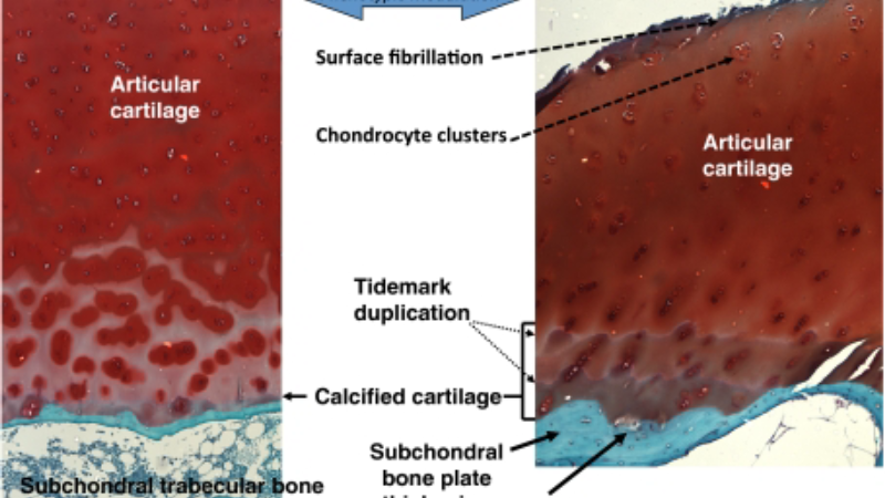 joint inflammation cytokines cartilage degradation