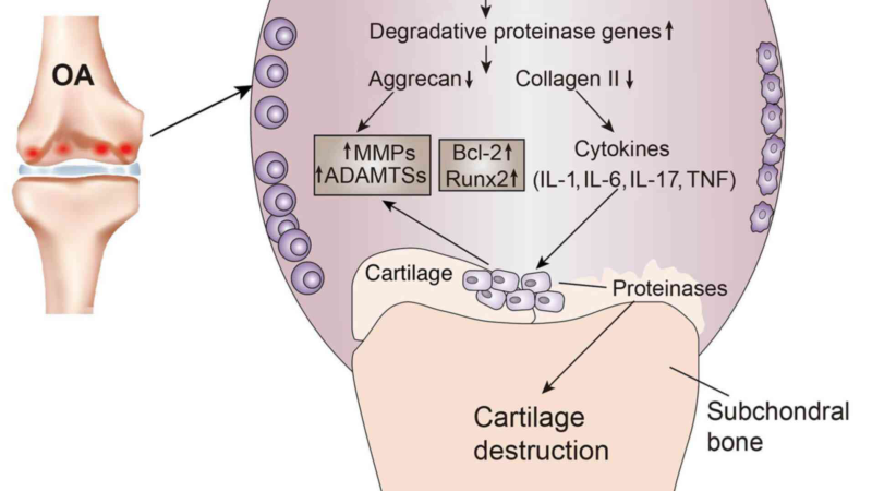 knee joint inflammation illustration showing cytokines and cartilage degradation