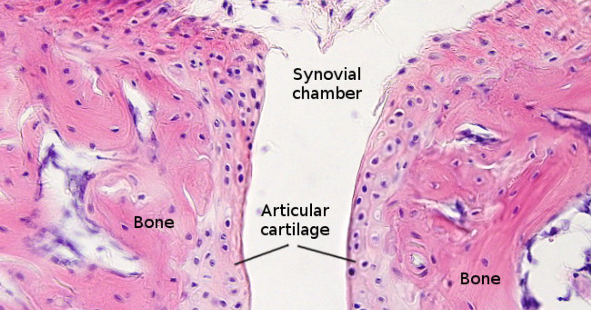 Arthryon: The Missing Link in Articular Cartilage Regeneration?
