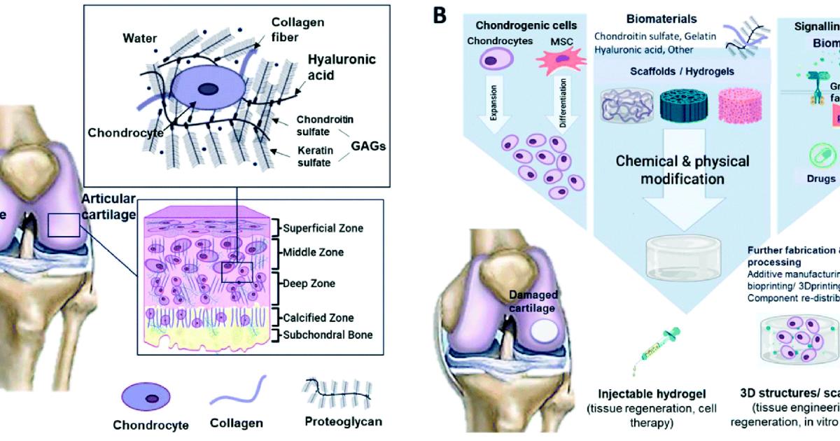 Nerve Calm: The Future of Cartilage Repair – From Synthetic Lubricants to Gene Therapy