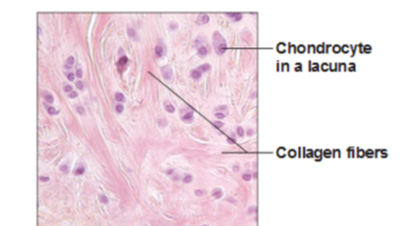 anatomy of knee joint showing articular cartilage and synovial fluid
