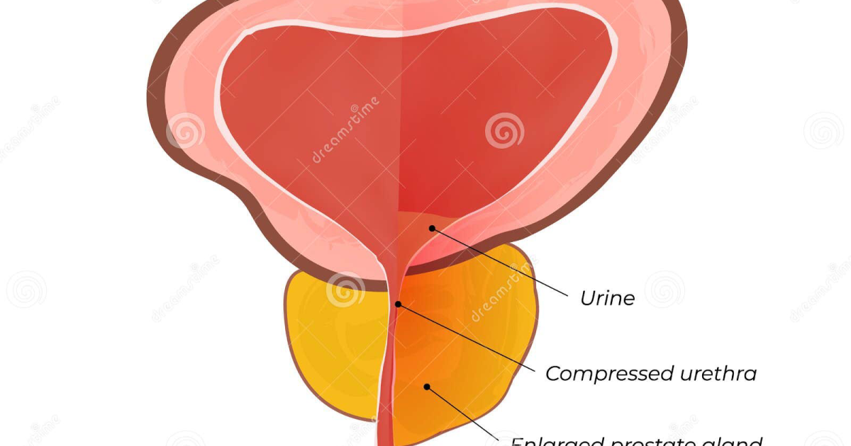 Alpha Surge: Targeting Cytokine Pathways to Reduce Prostate Inflammation for Long-Term Health