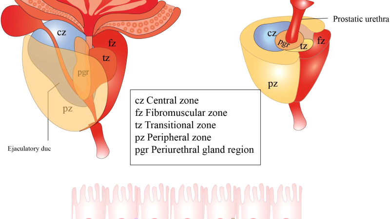 prostate gland anatomy cross-section showing urethral compression