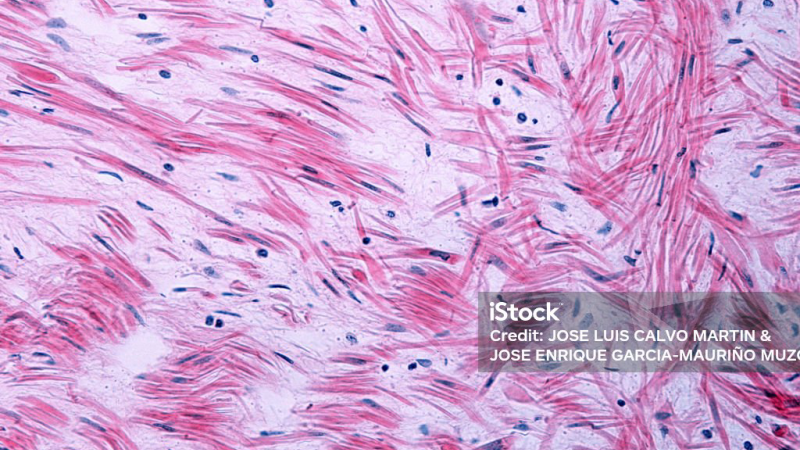 microscopic view of prostate tissue showing smooth muscle relaxation