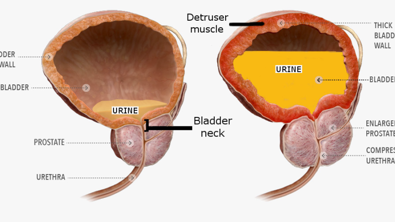 male lower urinary tract prostate illustration