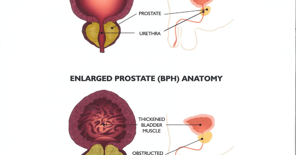 Primal Grow Pro: Optimizing Urinary Flow Rate – The Physiological Tricks That Improve Bladder Control Naturally