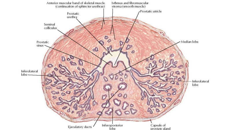 prostate anatomy cross-section showing inflammation