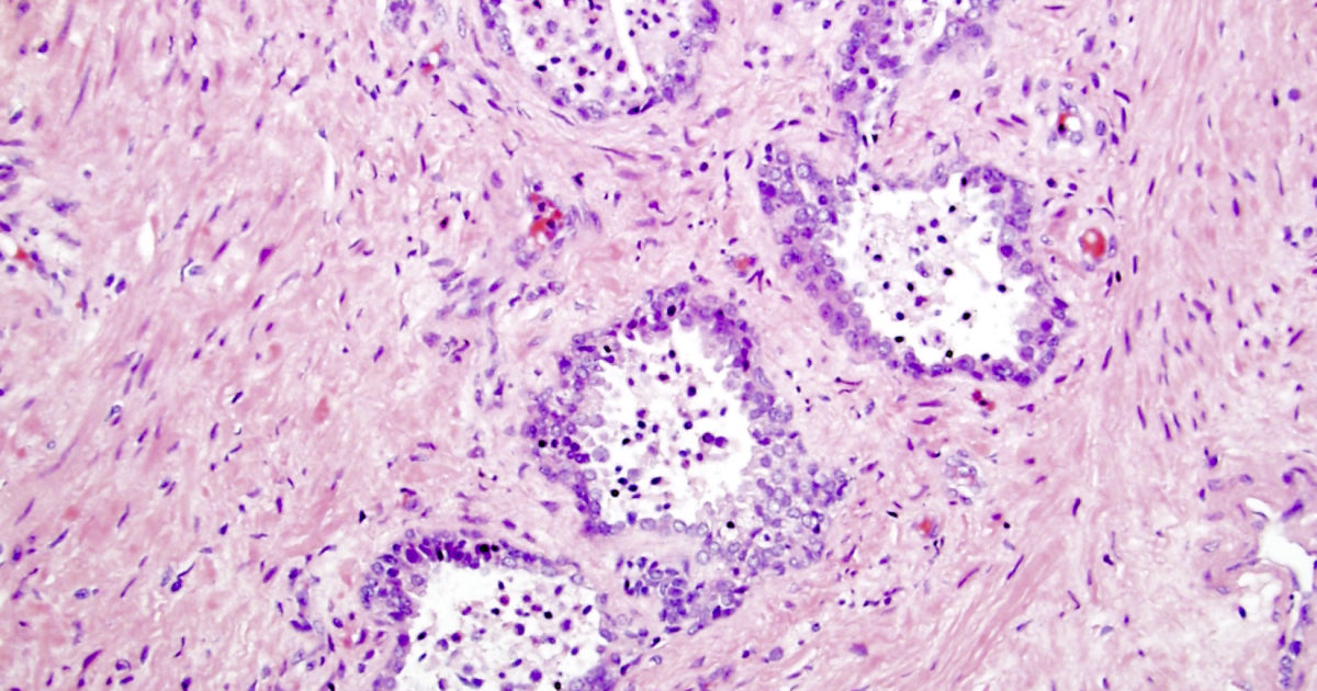 Primal Grow Pro: Why Prostate Cellular Inflammation Declines With Phytosterols