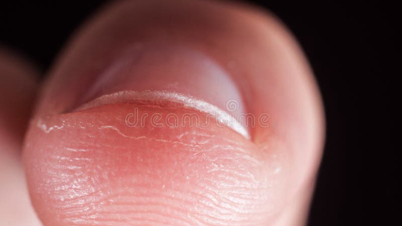 capillary network in nail bed illustration