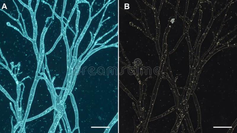 microscopic image of fungal hyphae and yeast cells on keratin