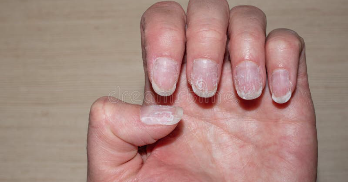 SupraNail: The Science of Nail Growth – How Keratin Synthesis and Blood Flow Determine Strength