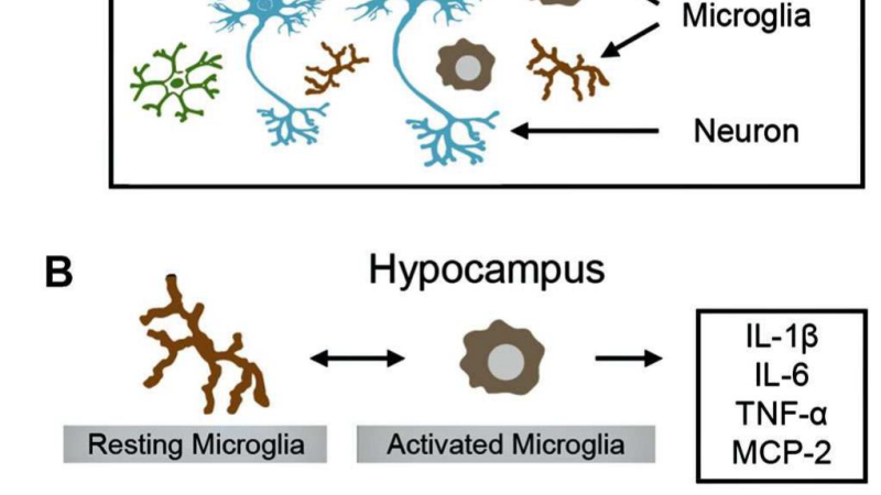 brain immune cells microglia activation inflammation